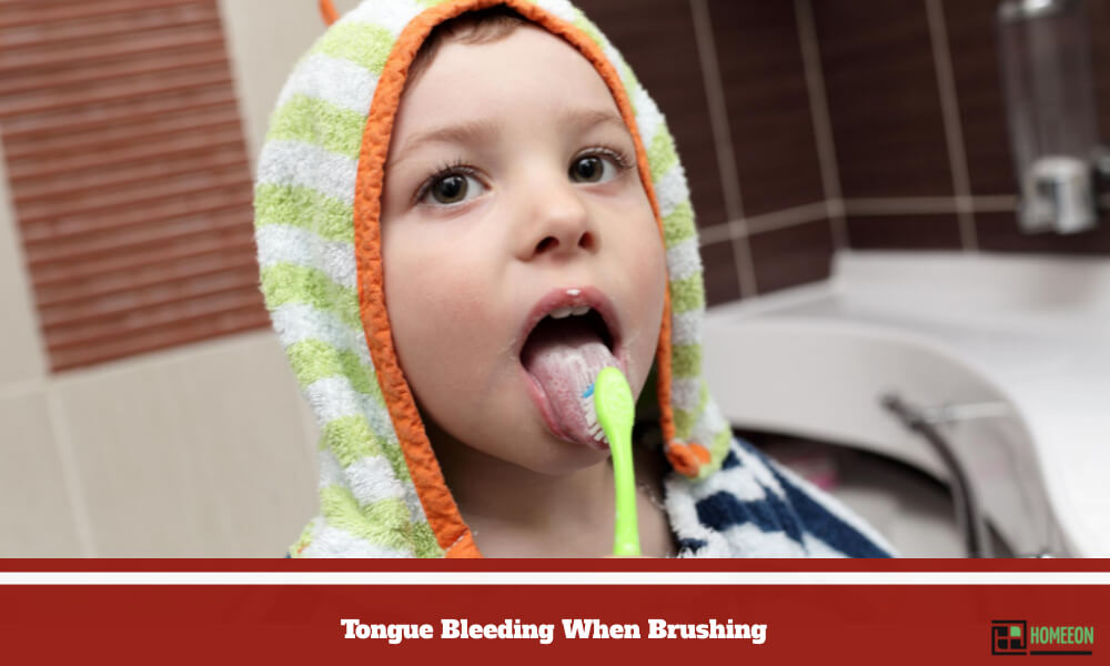 Tongue Bleeding When Brushing